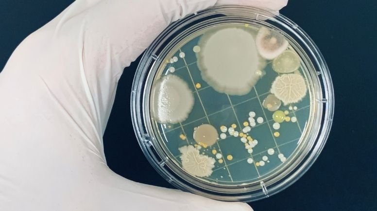 Antimicrobial Resistance and Stewardship